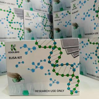 Rat Tumor Protein p53 (TP53) ELISA Kit KB-E2561R